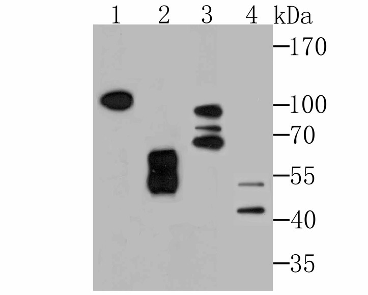 Fig1:; Western blot analysis of KDEL on different lysates. Proteins were transferred to a PVDF membrane and blocked with 5% BSA in PBS for 1 hour at room temperature. The primary antibody ( 1/500) was used in 5% BSA at room temperature for 2 hours. Goat Anti-Rabbit IgG - HRP Secondary Antibody (HA1001) at 1:40,000 dilution was used for 1 hour at room temperature.; Positive control:; Lane 1: Rat testis tissue lysate; Lane 2: Human placenta tissue lysate; Lane 3: Mouse testis tissue lysate; Lane 4: 293 cell lysate