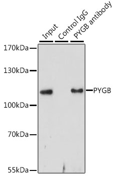 Immunoprecipitation - PYGB Polyclonal Antibody 