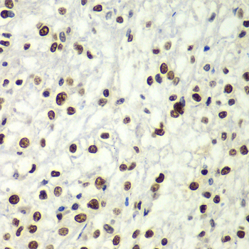 Immunohistochemistry - SF3B2 Polyclonal Antibody 