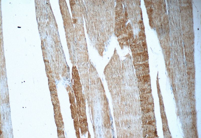 Immunohistochemistry of paraffin-embedded human skeletal muscle tissue slide using Catalog No:116551(UFD1L Antibody) at dilution of 1:50 (under 10x lens)