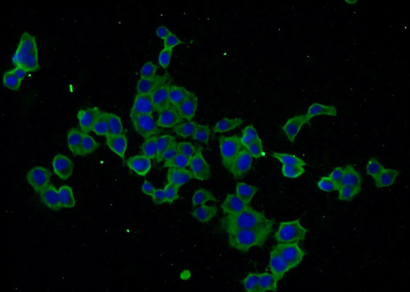 Immunofluorescent analysis of PC-12 cells using Catalog No:115008(SCN9A-Specific Antibody) at dilution of 1:50 and Alexa Fluor 488-congugated AffiniPure Goat Anti-Rabbit IgG(H+L)
