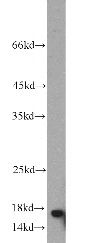 mouse thymus tissue were subjected to SDS PAGE followed by western blot with Catalog No:116507(UBE2N antibody) at dilution of 1:1000
