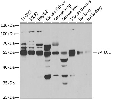 Western blot - SPTLC1 Polyclonal Antibody 