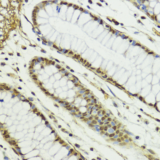 Immunohistochemistry - CTCF Polyclonal Antibody 