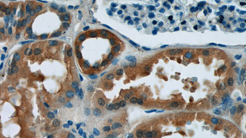 Immunohistochemistry of paraffin-embedded human kidney tissue slide using Catalog No:108352(ATP5D Antibody) at dilution of 1:50 (under 40x lens)
