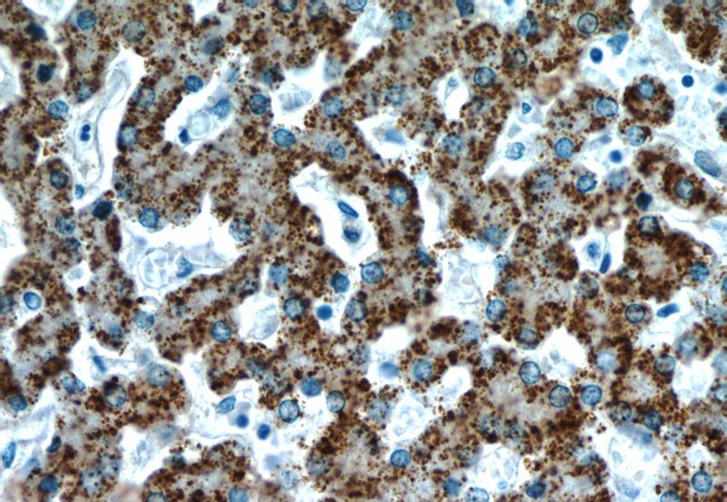 Immunohistochemistry of paraffin-embedded human liver slide using Catalog No:107840(AGXT Antibody) at dilution of 1:50