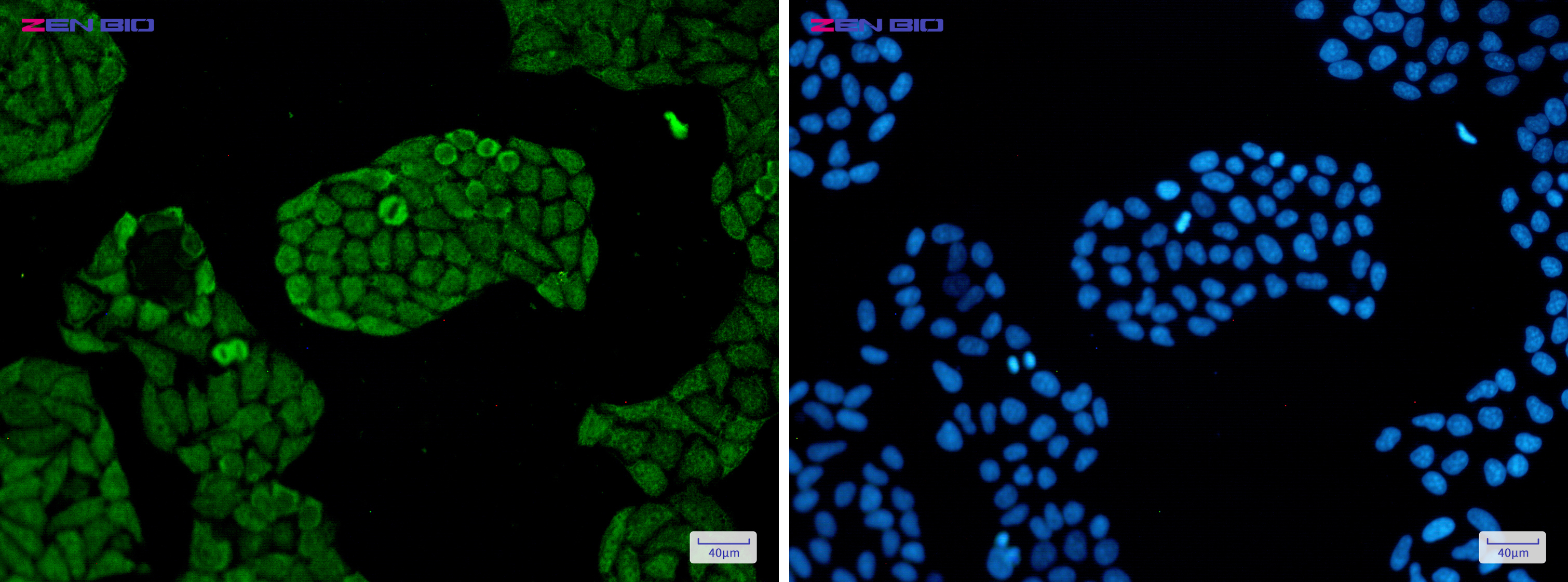 Immunocytochemistry of PSMC5(green) in Hela cells using PSMC5 Rabbit mAb at dilution 1/50, and DAPI(blue)