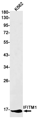 Western blot detection of IFITM1 in K562 cell lysates using IFITM1 Rabbit mAb(1:1000 diluted).Predicted band size:14kDa.Observed band size:14kDa.