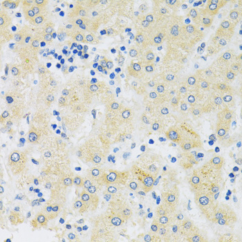 Immunohistochemistry - SLC39A7 Polyclonal Antibody 