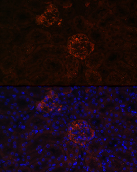 Immunofluorescence - NPHS1 Polyclonal Antibody 