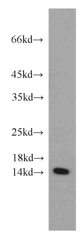 mouse liver tissue were subjected to SDS PAGE followed by western blot with Catalog No:113908(PIN4 antibody) at dilution of 1:500