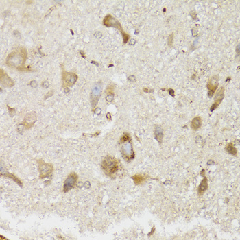 Immunohistochemistry - NDUFS7 Polyclonal Antibody 