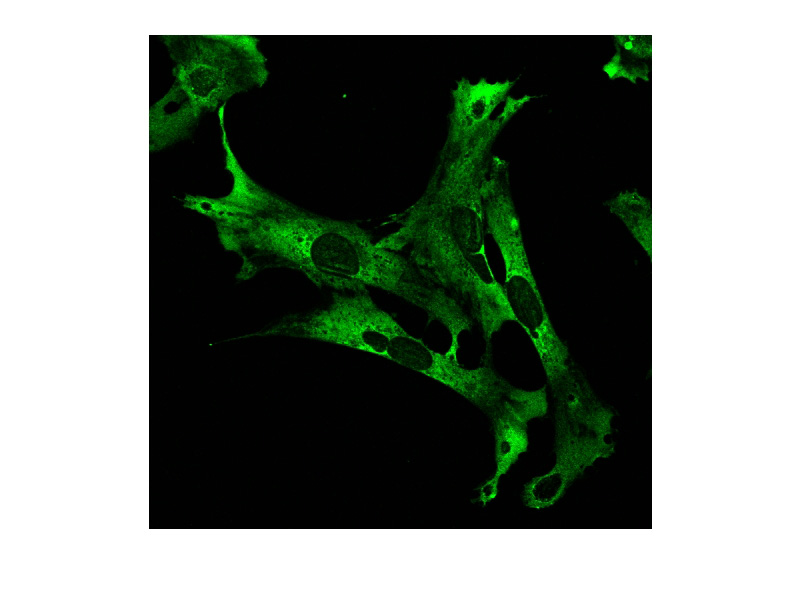 IF result of anti-CAPRIN1(Catalog No:108839, 1:200) with oc2 cells by Dr. Emily Towers.