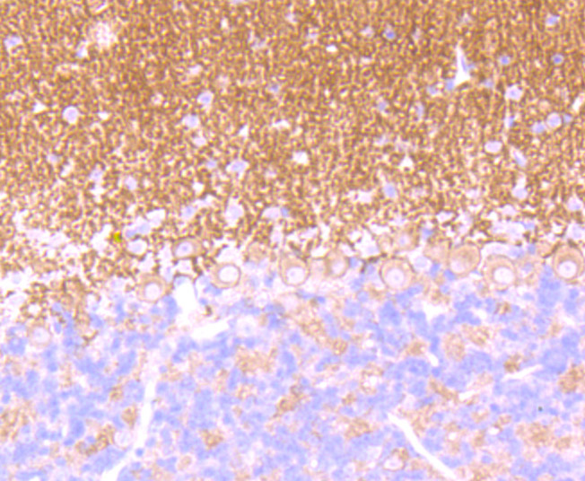Fig3: Immunohistochemical analysis of paraffin-embedded mouse cerebellum tissue using anti- GABA B Receptor 2 antibody. Counter stained with hematoxylin.