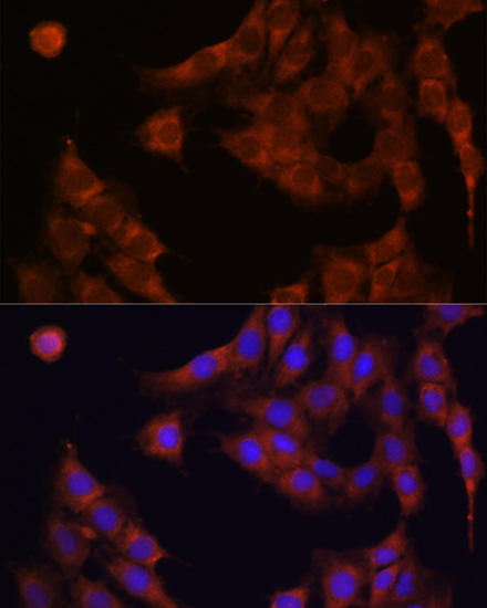Immunofluorescence - GANAB Polyclonal Antibody 