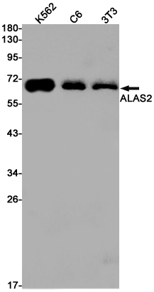 Western blot detection of ALAS2 in K562,C6,3T3 cell lysates using ALAS2 Rabbit pAb(1:1000 diluted).Predicted band size:65kDa.Observed band size:65kDa.