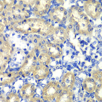 Immunohistochemistry - ABAT Polyclonal Antibody 