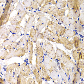 Immunohistochemistry - MBNL1 Polyclonal Antibody 