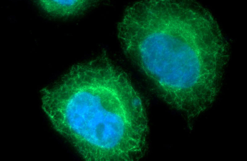 Immunofluorescent analysis of HeLa cells using Catalog No:109805(KRT20 Antibody) at dilution of 1:50 and Alexa Fluor 488-congugated AffiniPure Goat Anti-Rabbit IgG(H+L)