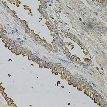 Immunohistochemistry - FMR1NB Polyclonal Antibody 