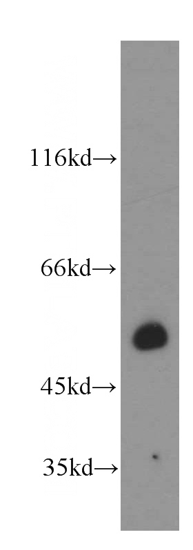 mouse cerebellum tissue were subjected to SDS PAGE followed by western blot with Catalog No:113478(PACSIN1 antibody) at dilution of 1:100