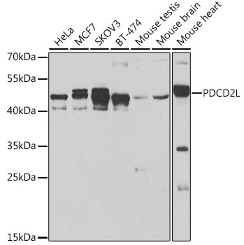 Western blot - PDCD2L Polyclonal Antibody 