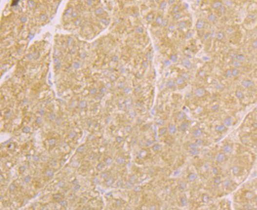 Fig3: Immunohistochemical analysis of paraffin-embedded human liver tissue using anti-Osteoprotegerin antibody. Counter stained with hematoxylin.