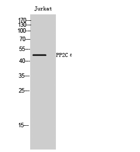 Fig1:; Western Blot analysis of Jurkat cells using PP2Cε Polyclonal Antibody