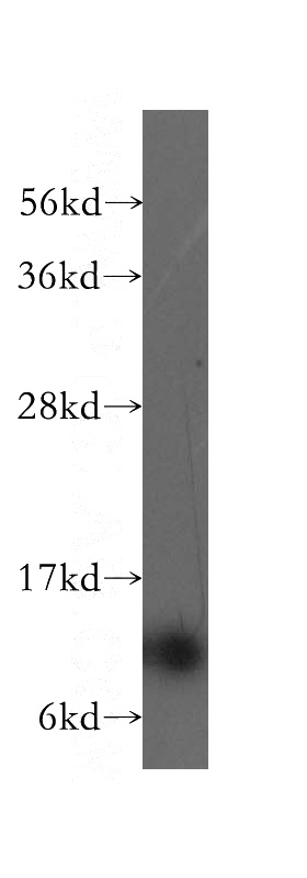 PC-3 cells were subjected to SDS PAGE followed by western blot with Catalog No:116130(TIMM13 antibody) at dilution of 1:300