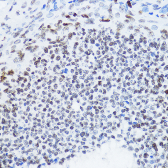 Immunohistochemistry - Acetyl-Histone H4-K12 pAb 