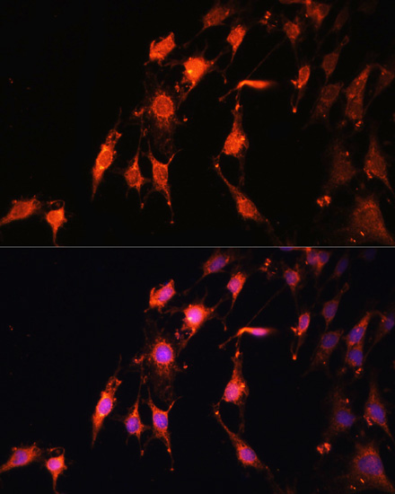 Immunofluorescence - PRR5 Polyclonal Antibody 