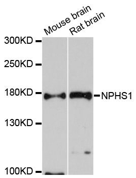 Western blot - NPHS1 Polyclonal Antibody 