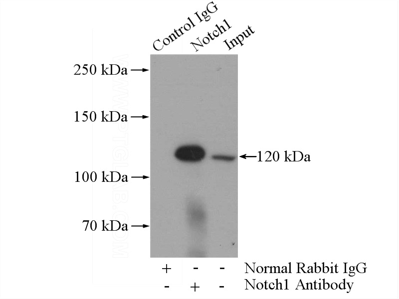 IP Result of anti-Notch1 (IP:Catalog No:113307, 5ug; Detection:Catalog No:113307 1:200) with HeLa cells lysate 2000ug.