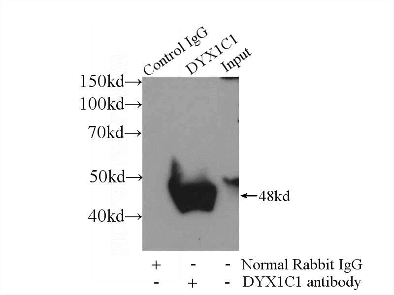 IP Result of anti-DYX1C1 (IP:Catalog No:110150, 4ug; Detection:Catalog No:110150 1:500) with mouse testis tissue lysate 4000ug.