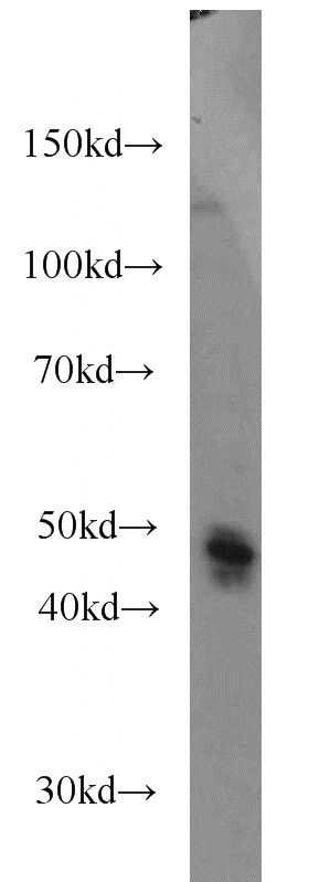 HeLa cells were subjected to SDS PAGE followed by western blot with Catalog No:107563(AHCY antibody) at dilution of 1:1000