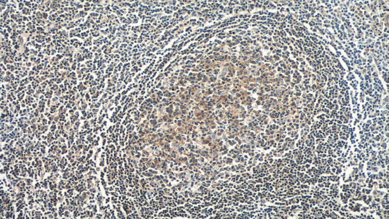 Immunohistochemistry of paraffin-embedded human tonsillitis tissue slide using Catalog No:109848(DEF6 Antibody) at dilution of 1:50 (under 10x lens)