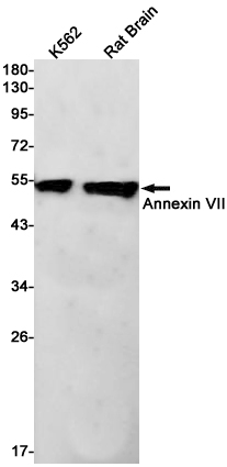 Western blot detection of Annexin VII in K562,Rat Brain cell lysates using Annexin VII Rabbit pAb(1:1000 diluted).Predicted band size:53kDa.Observed band size:53kDa.