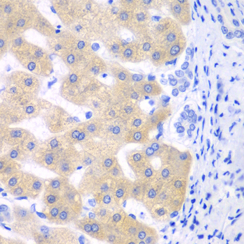 Immunohistochemistry - CYP2C18 Polyclonal Antibody 