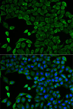 Immunofluorescence - SLC25A13 Polyclonal Antibody 
