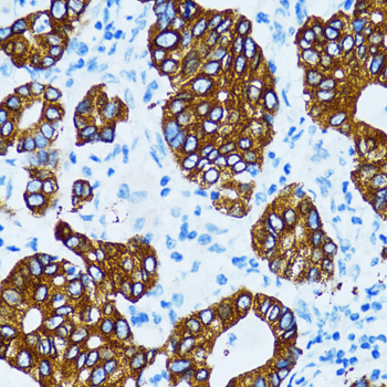 Immunohistochemistry - CTSE Polyclonal Antibody 