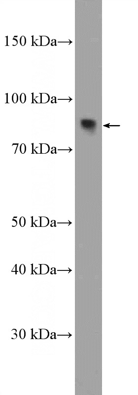 mouse kidney tissue were subjected to SDS PAGE followed by western blot with Catalog No:117010(ZNF600-Specific Antibody) at dilution of 1:300