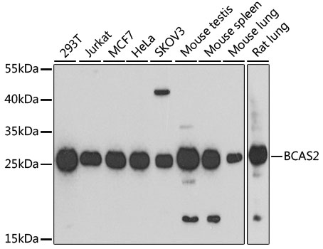 Western blot - BCAS2 Polyclonal Antibody 