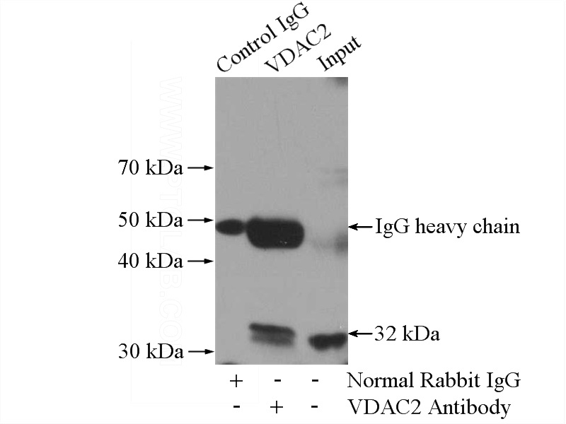 IP Result of anti-VDAC2 (IP:Catalog No:116730, 4ug; Detection:Catalog No:116730 1:500) with mouse heart tissue lysate 3200ug.