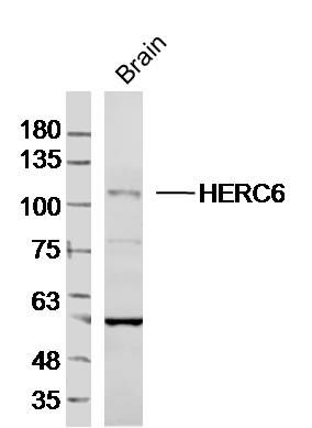Fig4: Sample:Brain (Mouse) Lysate at 40 ug; Primary: Anti-HERC6 at 1/300 dilution; Secondary: IRDye800CW Goat Anti-Rabbit IgG at 1/20000 dilution; Predicted band size: 115kD; Observed band size: 115kD