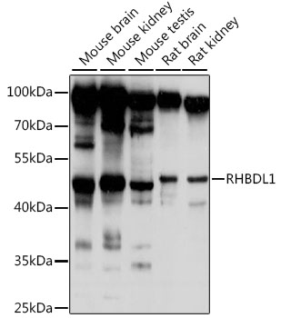 Western blot - RHBDL1 Polyclonal Antibody 