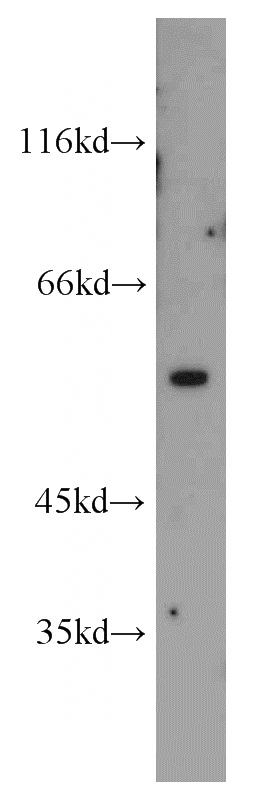 HEK-293 cells were subjected to SDS PAGE followed by western blot with Catalog No:116754(VIM antibody) at dilution of 1:1000