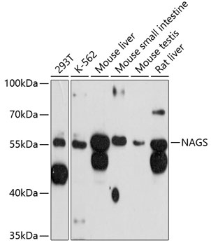 Western blot - NAGS Polyclonal Antibody 