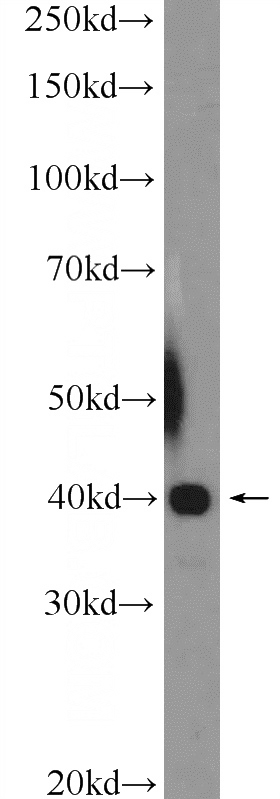 K-562 cells were subjected to SDS PAGE followed by western blot with Catalog No:116669(UBXN10 Antibody) at dilution of 1:1000