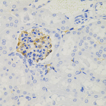 Immunohistochemistry - NPHS1 Polyclonal Antibody 