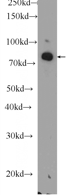 mouse cerebellum tissue were subjected to SDS PAGE followed by western blot with Catalog No:109909(DGKA Antibody) at dilution of 1:1000